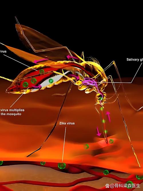 _寨卡病毒哪个国家疫情最严重_寨卡病毒中国有吗